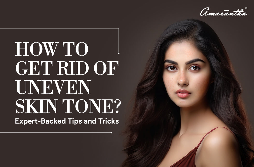 How to Get Rid of Uneven Skin Tone? Expert-Backed Tips and Tricks