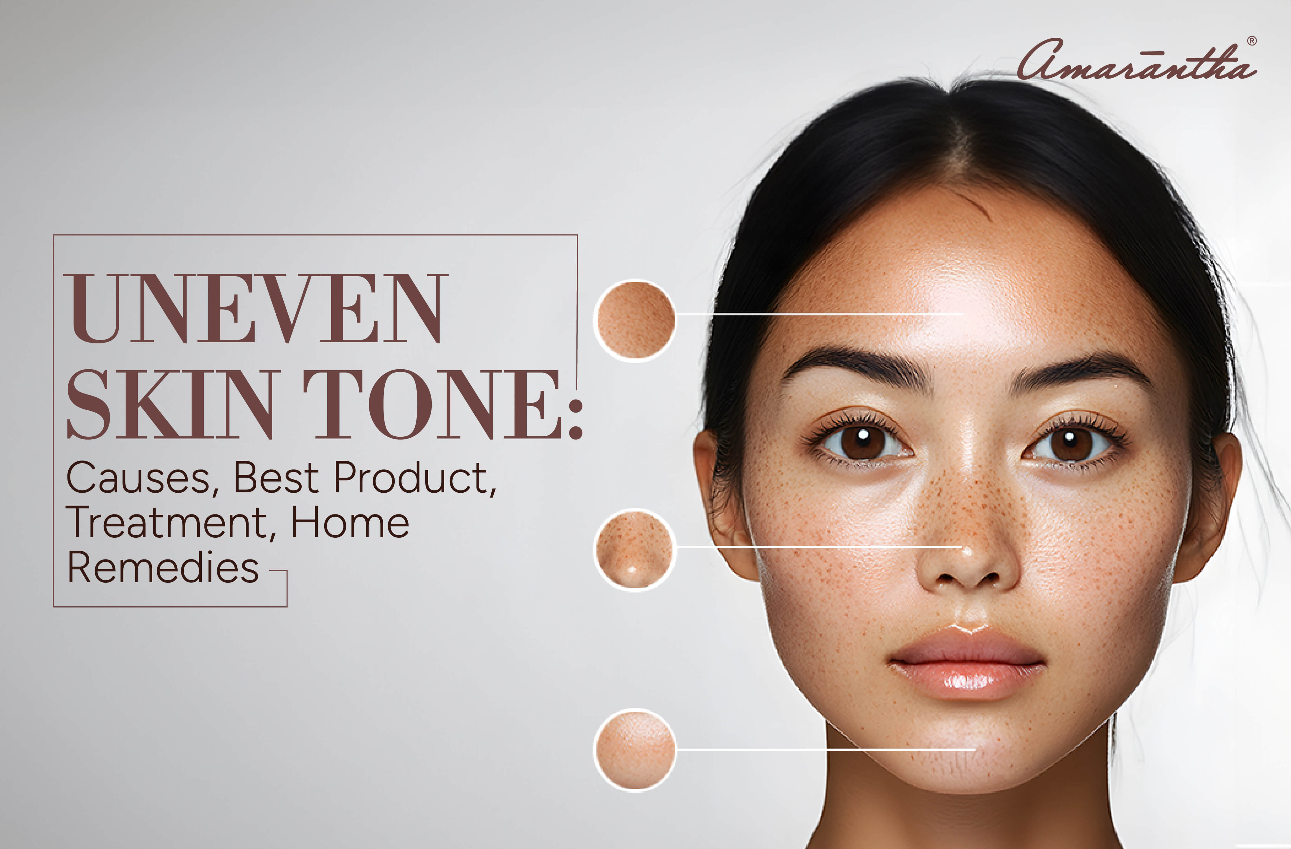 Uneven Skin Tone